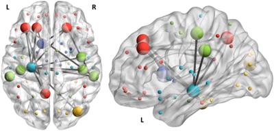 The Predictive Processing Model of EMDR